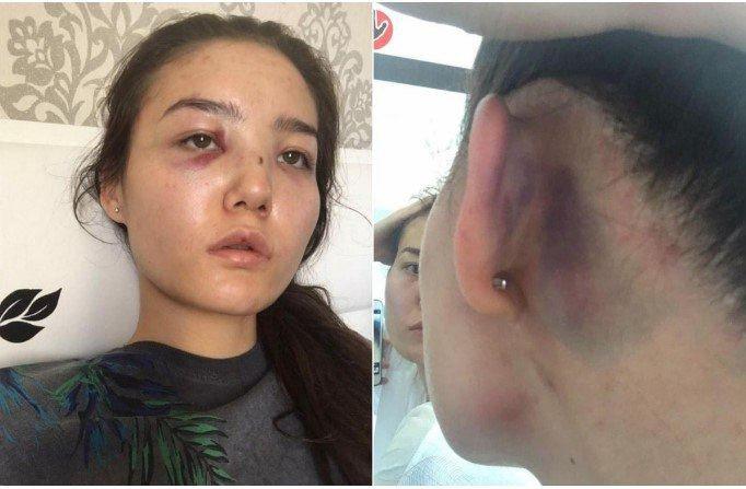 Жена казахстанского дипломата сообщила об избиениях со стороны супруга на протяжении 10 лет