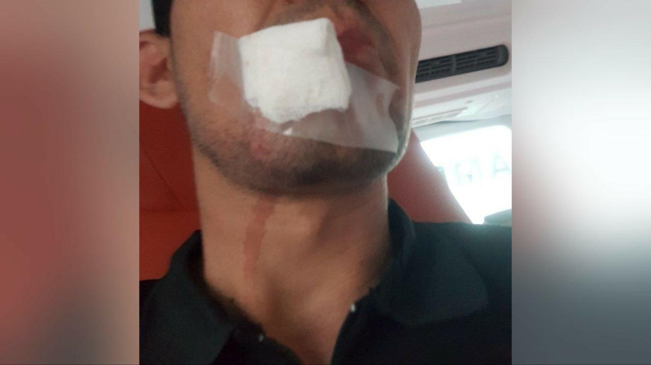 В Ташкентской области мужчина избил врача скорой помощи