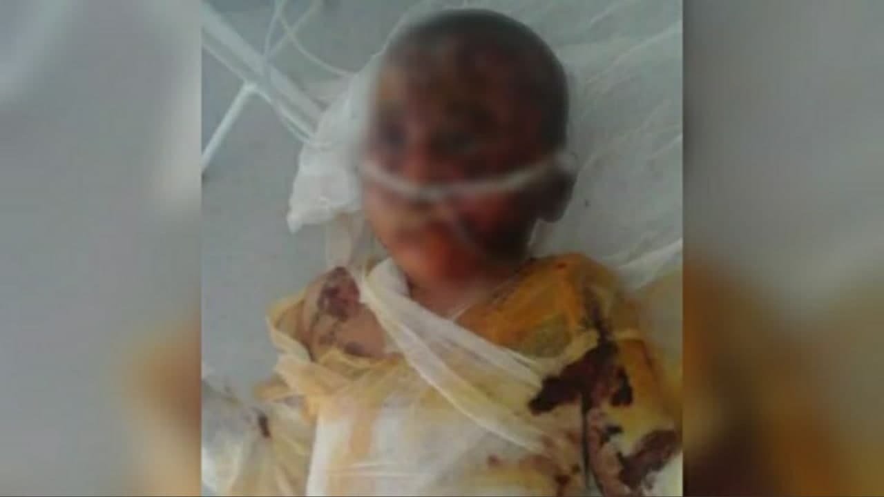 В Намангане шестилетний ребенок скончался от ожогов
