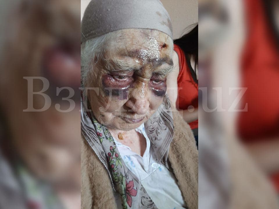 В Ташкенте бабушку жестоко избили её дочь и внучка – фото, видео