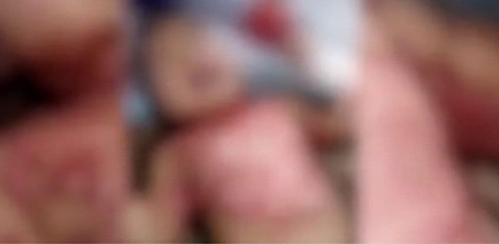 В Андижане скончалась 3-летняя девочка после того, как мужчина облил её кипятком – видео