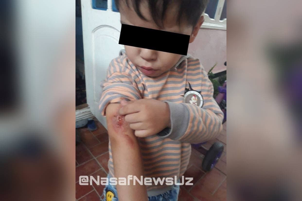 В Шахрисабзе 5-летний мальчик получил ожог в детском саду – видео