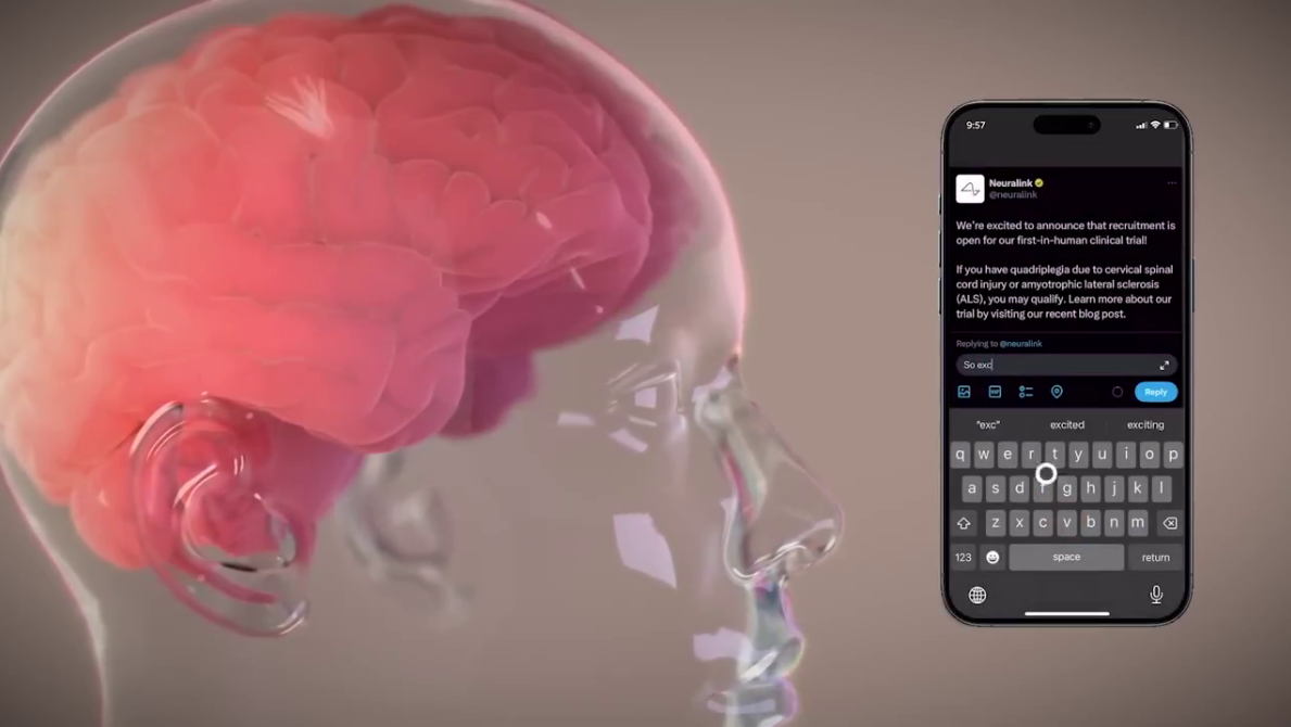 Первый человек с вживленным мозговым чипом полностью выздоровел и мысленно управляет компьютерной мышью, — Илон Маск