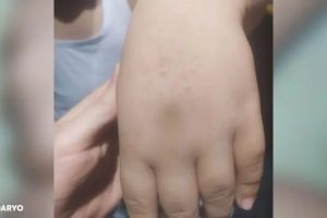 На учителя, которая колола детям руки, завели уголовное дело