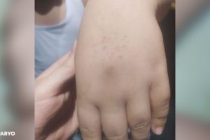 В Ташкенте уволили учительницу, которая колола руки первоклассникам иголками и саморезами