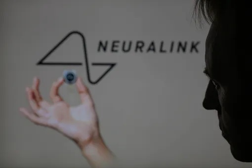 Neuralink разрешили вживить чип в мозг второму добровольцу