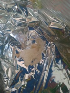 Daryo: В Намангане после кесарева сечения у женщины нашли в животе бинт и резиновые перчатки