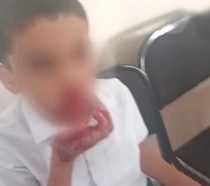 Қашқадарёда инглиз тили ўқитувчиси ўқувчининг бурнини синдирди