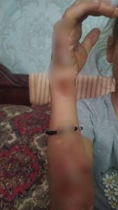 Бухорода аёл қизининг танасига қизиган капгир босди