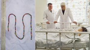 Toshkentda bolaning oshqozonidan 135 dona magnit sharcha olindi