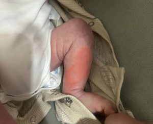 Toshkent viloyatida ayol oilaviy mojaro vaqtida tasodifan bolasini qaynoq suv bilan kuydirib qoʻydi